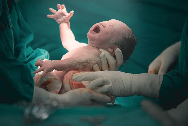Normal and Cesarean Delivery
